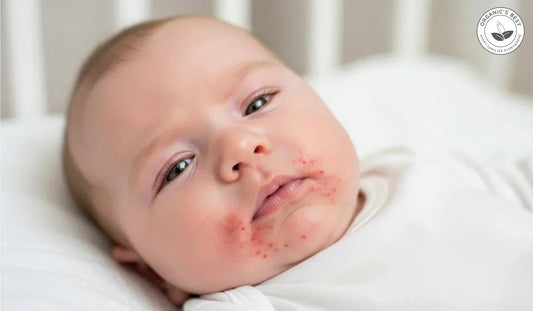 Baby Food Allergies: How to Introduce Common Allergens Safely